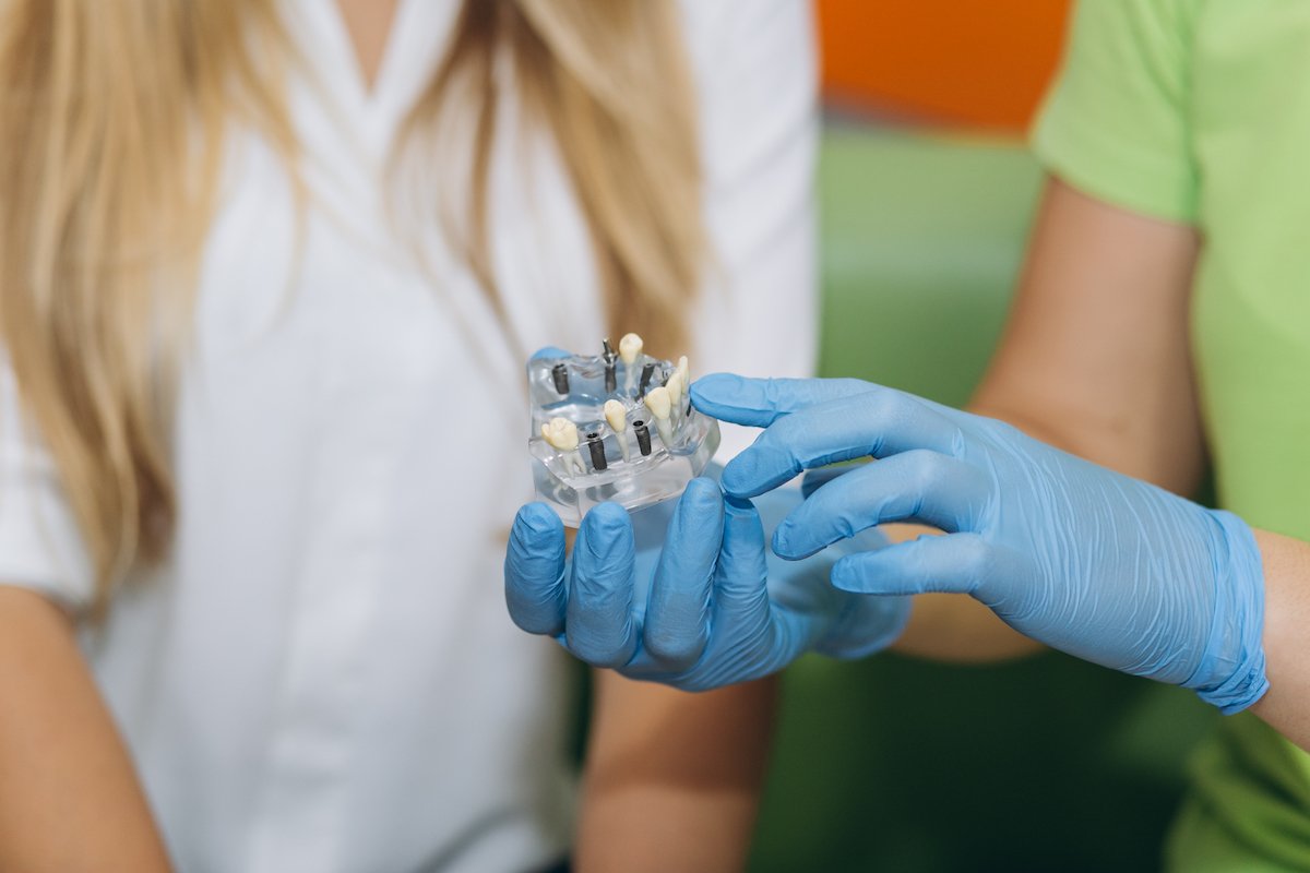 I Damaged My Dental Implant – Is It Serious, And What Can I Do?
